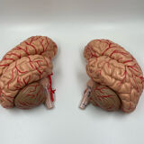 Anatomical brain model