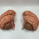 Anatomical brain model