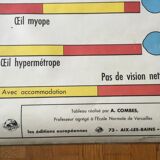 Educational poster digestion and the eye and vision