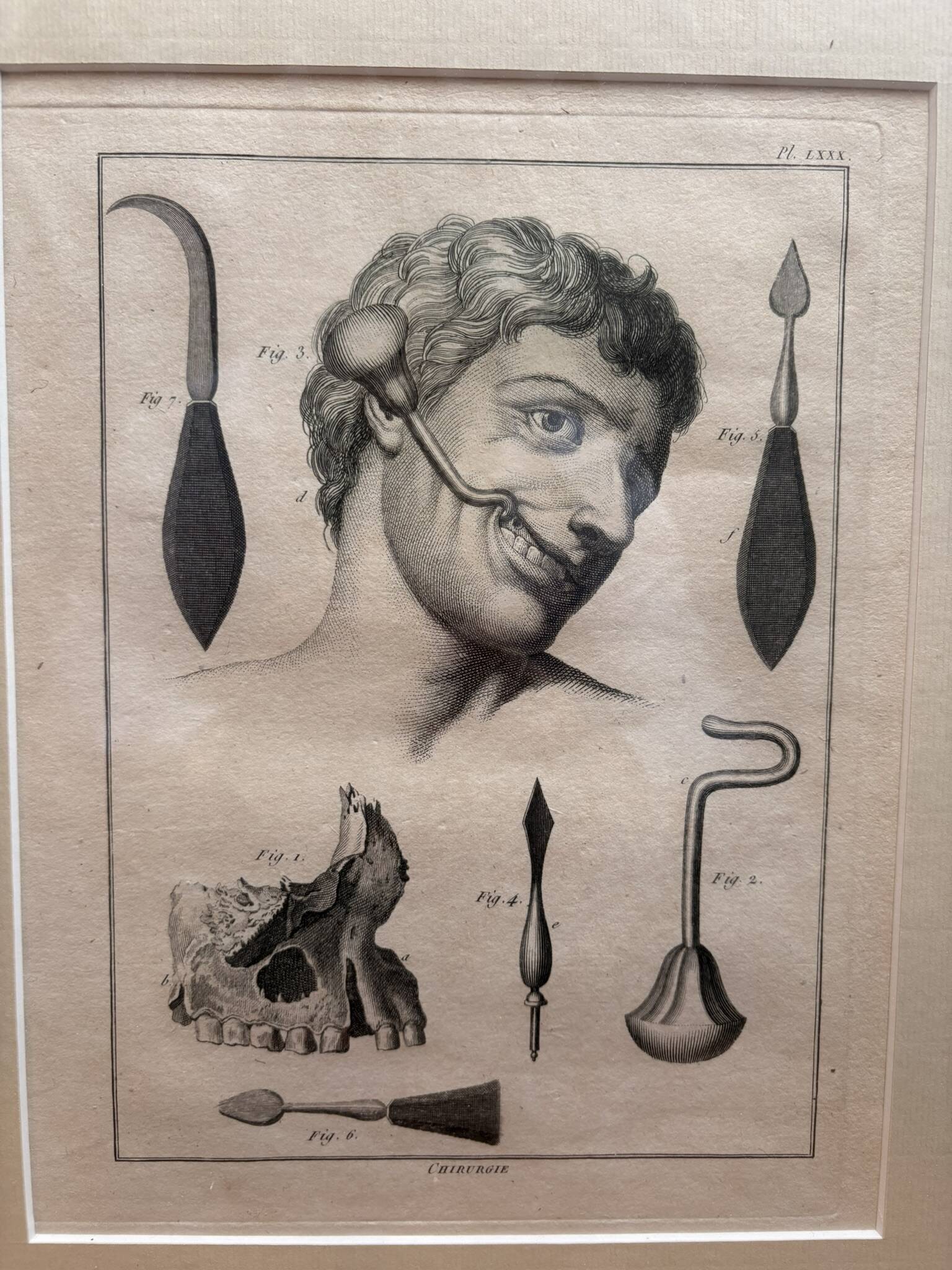 Old Print Engraving Framed Aphorisms Surgery Anatomy Herman Boerhaave