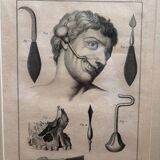 Old Print Engraving Framed Aphorisms Surgery Anatomy Herman Boerhaave