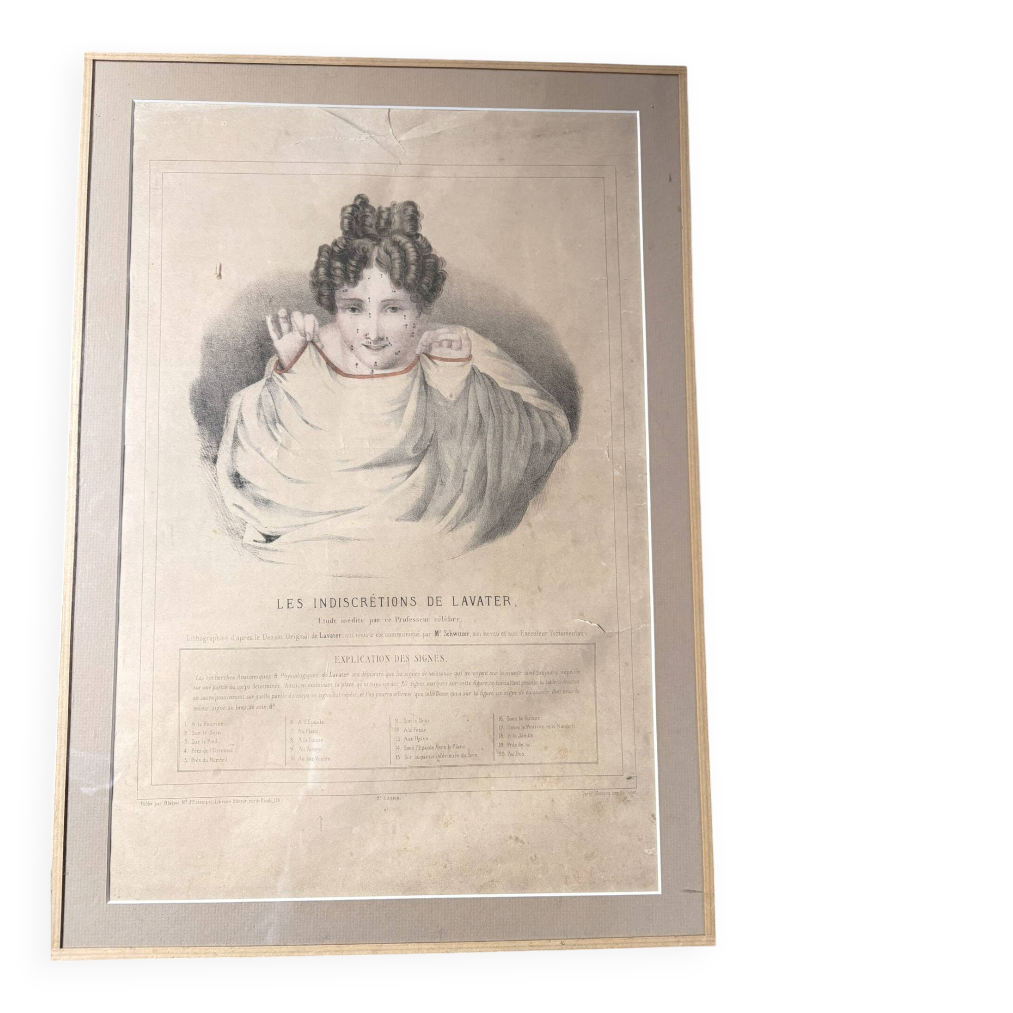 Gravure 19th Century Anatomy Face Woman ANGELO ZAFFONATO "Five Senses"