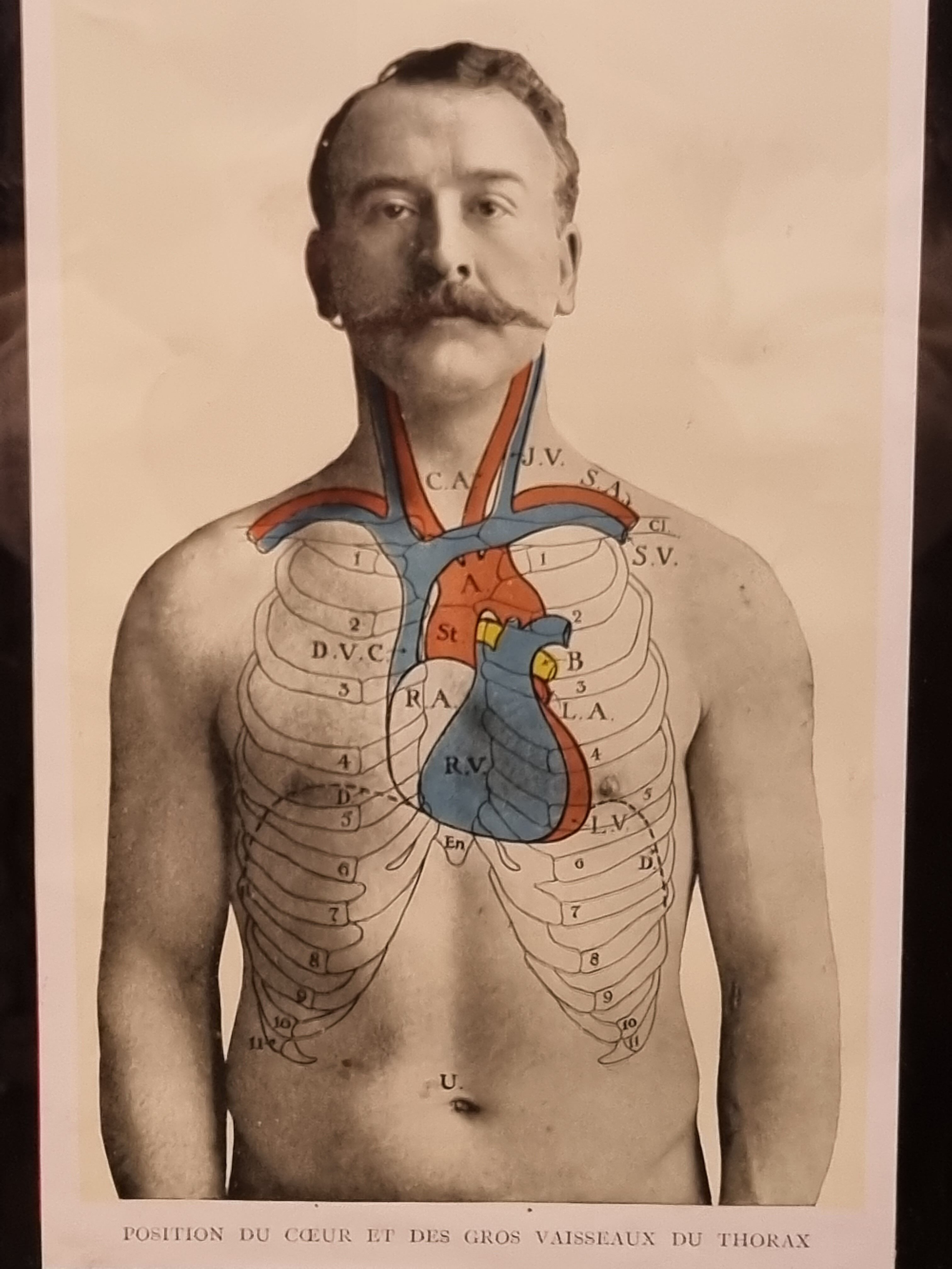 Photo frame book medicine