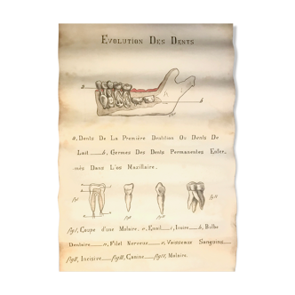 Anatomical plank evolution of teeth