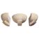 Art Deco wall lights in patinated plaster, France, 1925, set of 3