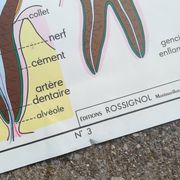 Vintage school poster N°3 Teeth N°4 Digestion Rossignol