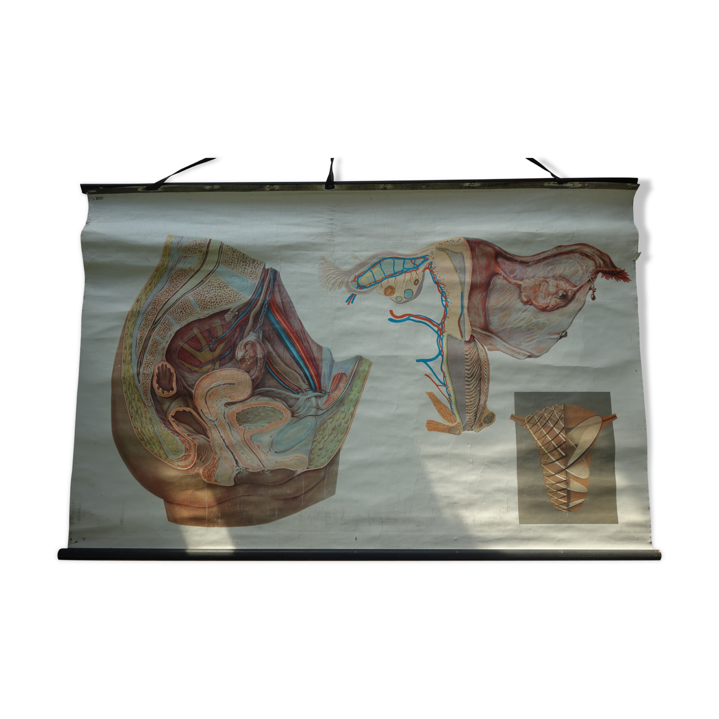 Ancient medical poster