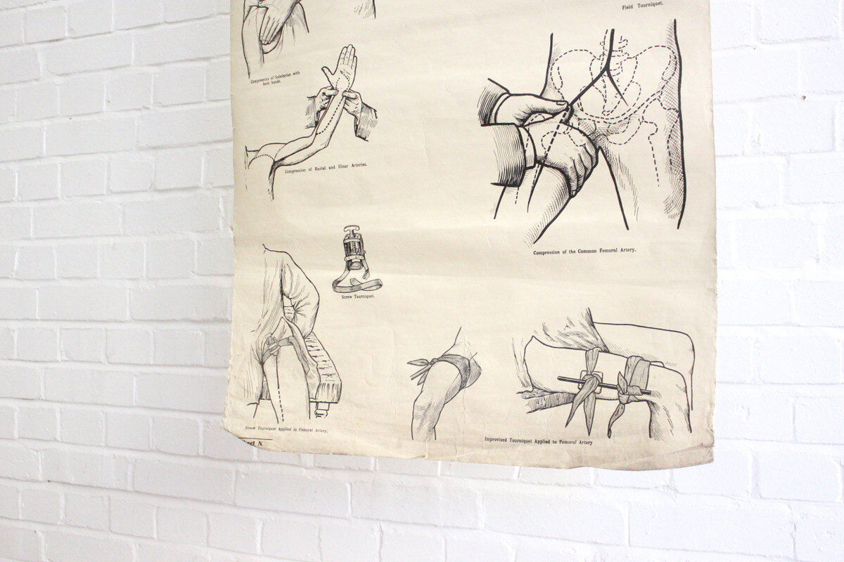 Displays educational anatomical bleeding