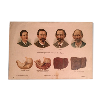 Ancient anatomical plank
