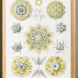 Poster about polycystic kidney stones, based on an old lithograph from 1904.