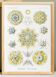 Poster about polycystic kidney stones, based on an old lithograph from 1904.