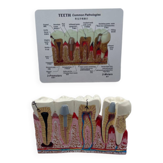 Modèle anatomique dentaire