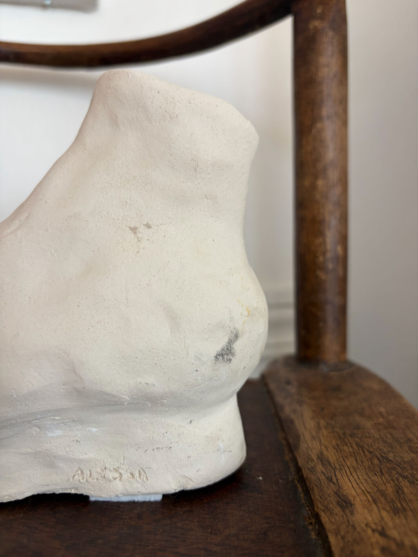 White plaster foot cast