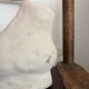 White plaster foot cast