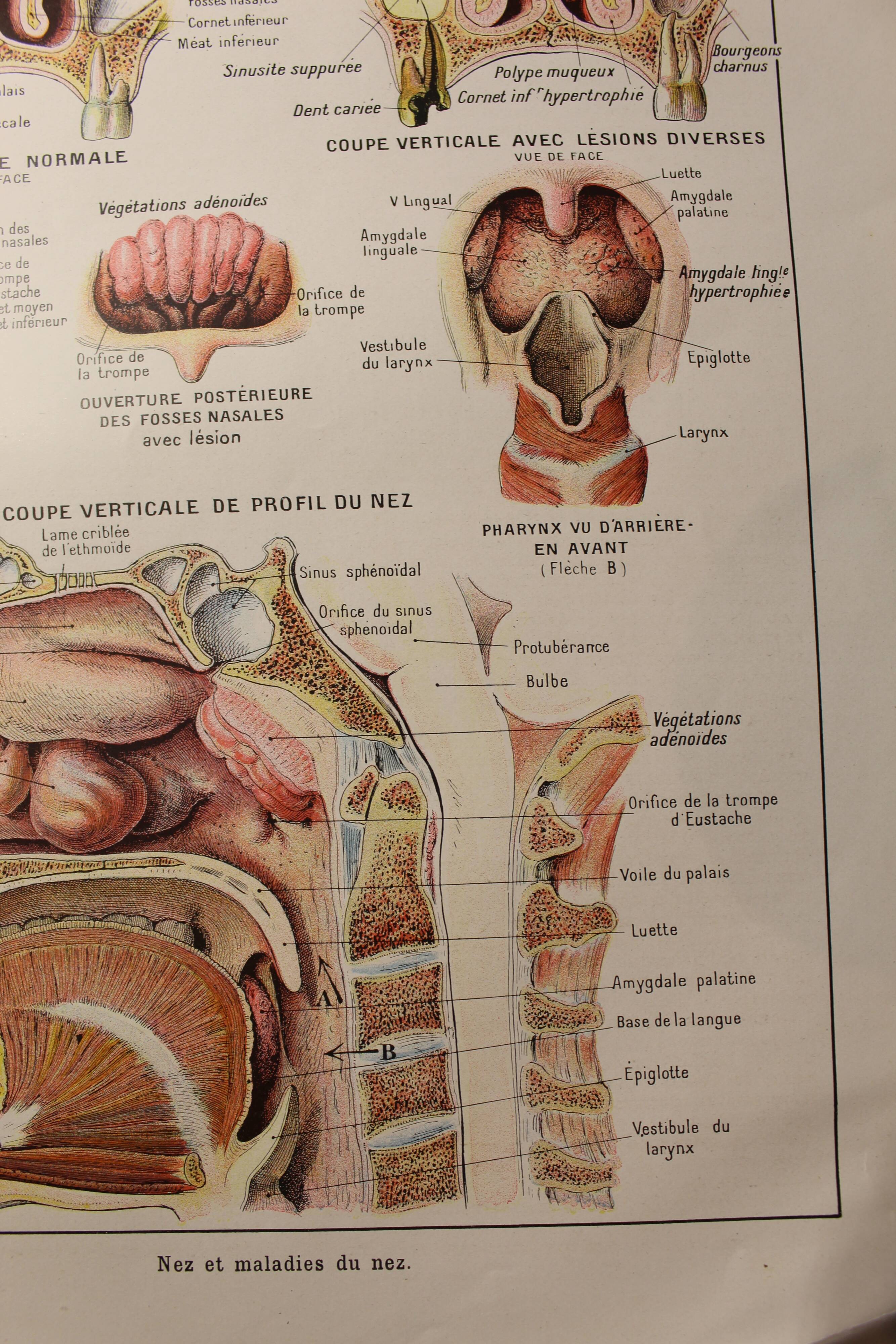 Medical board - anatomy - nose