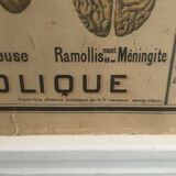 Educational panel "Alcohol is the enemy" 1910