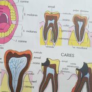 Vintage school poster N°3 Teeth N°4 Digestion Rossignol