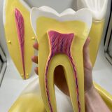 Large size dental model 3 teeth