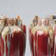 Pair of Sculptural Art Deco Glazed Ceramic Vases, Belgium 1930s