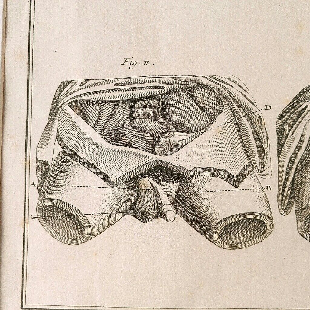 Engravings EIGHTEENth hermaphrodites Diderot cabinet curiosity