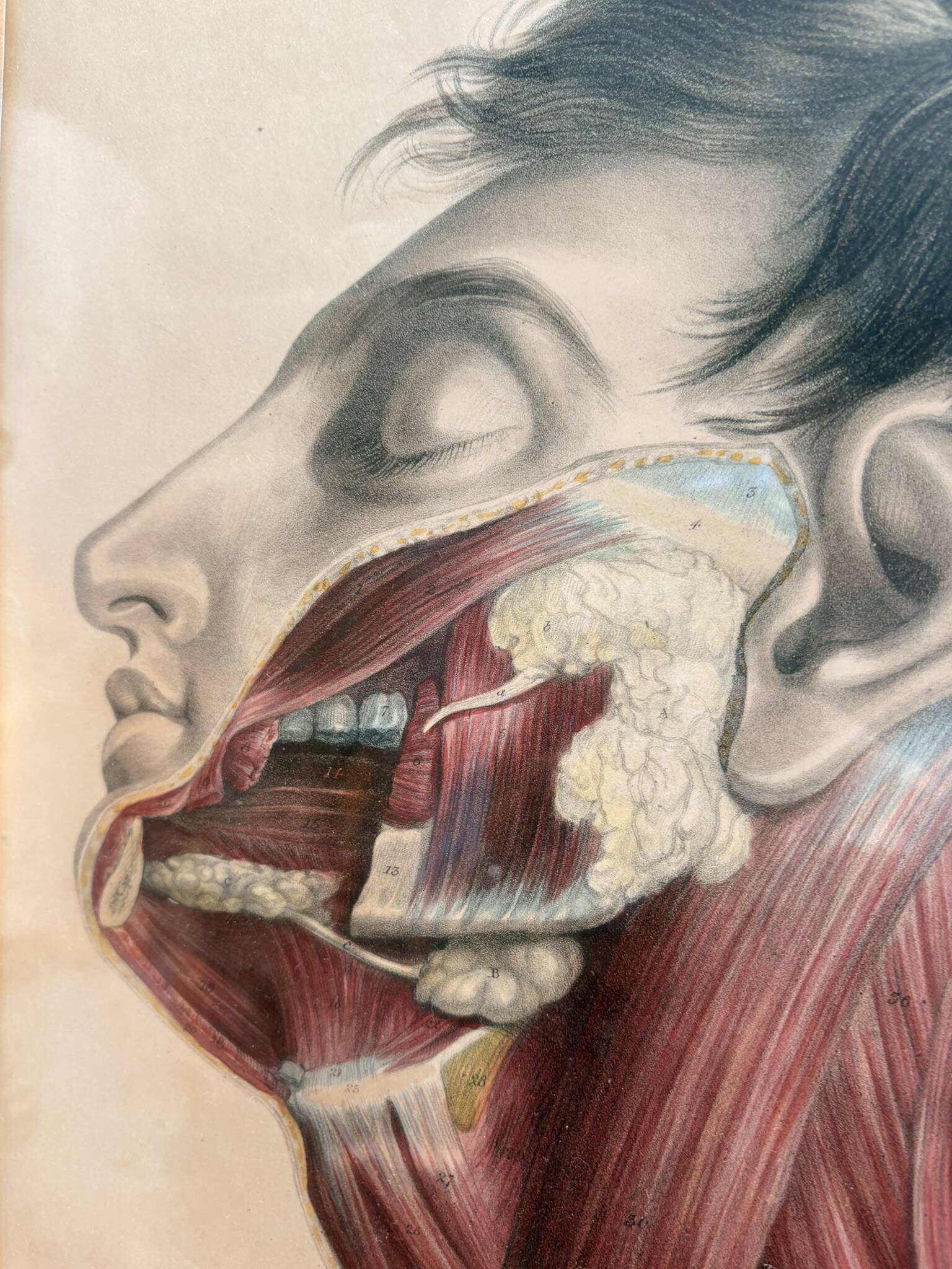 Print Engraving 19th Century The Salivary Gland Head Anatomy William Bagg
