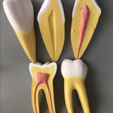 Large size dental model 3 tooth