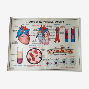 Poster school - heart vessels and duplex absorption