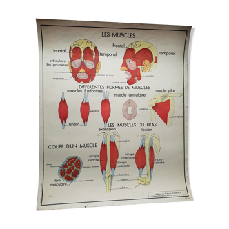 Affiche scolaire Rossignol N°13 Cyphose scoliose  N°14 Les muscles