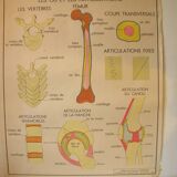 Old school poster Rossignol Bones and joints and accidents 90 cm