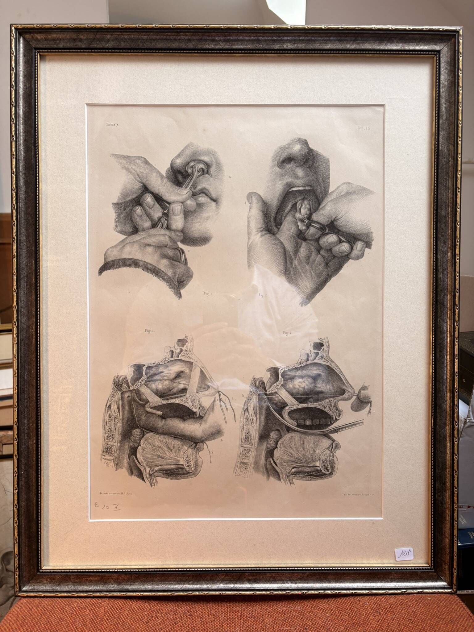 Old Engraving Nose Nasal Cavity NICOLAS HENRI Jacob Bourgery Medical Anatomy