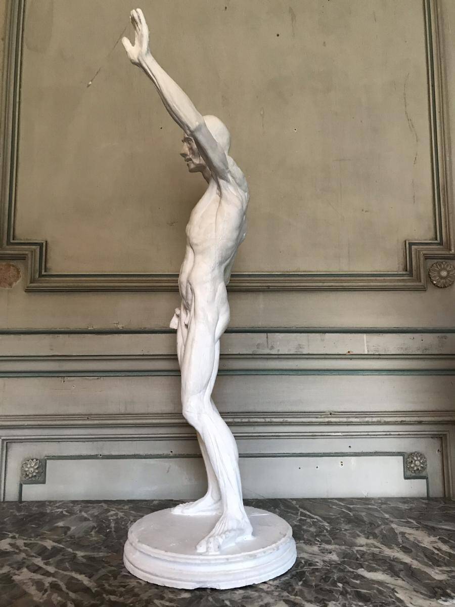 Plaster cast of a flayed figure