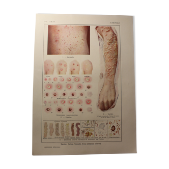Medical board - anatomy - Variriole