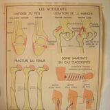 Old school poster Rossignol Bones and joints and accidents 90 cm