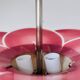 Art Deco ceiling light by Loys Lucha