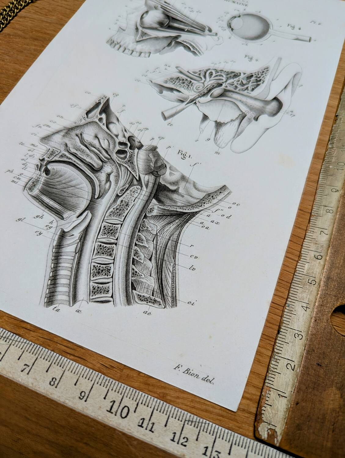 Printed in 1851, Human Anatomy, the head.