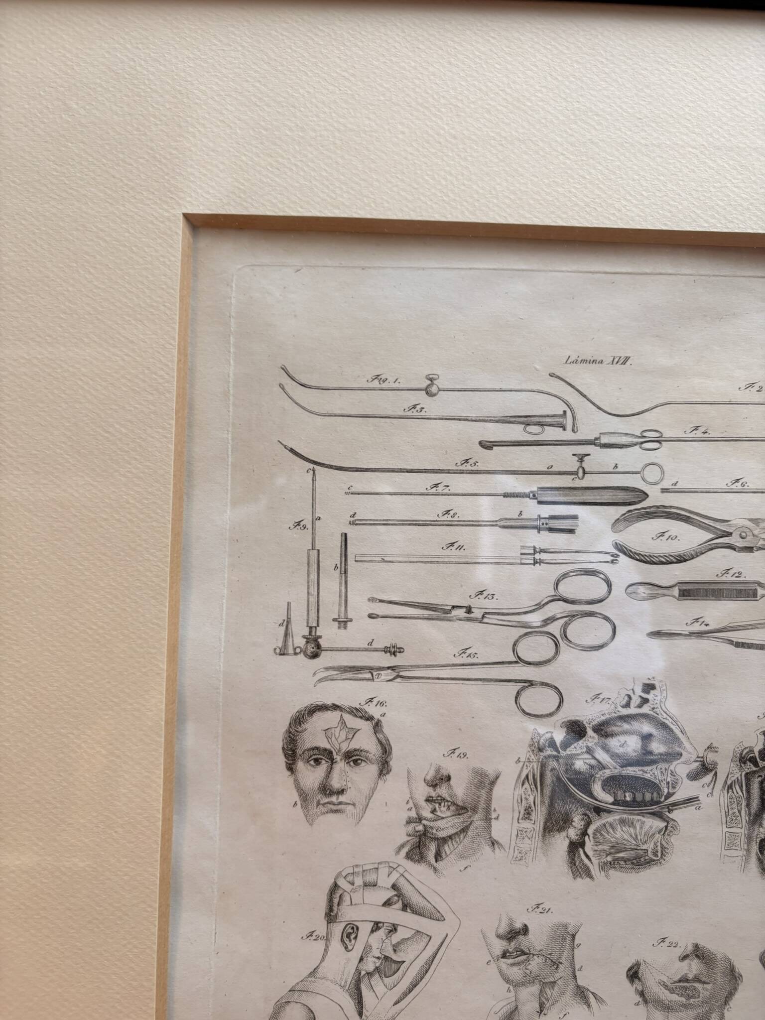 Engraving 19th century Nicolas Jacob Bourgery Medical instruments Anatomy Surgery