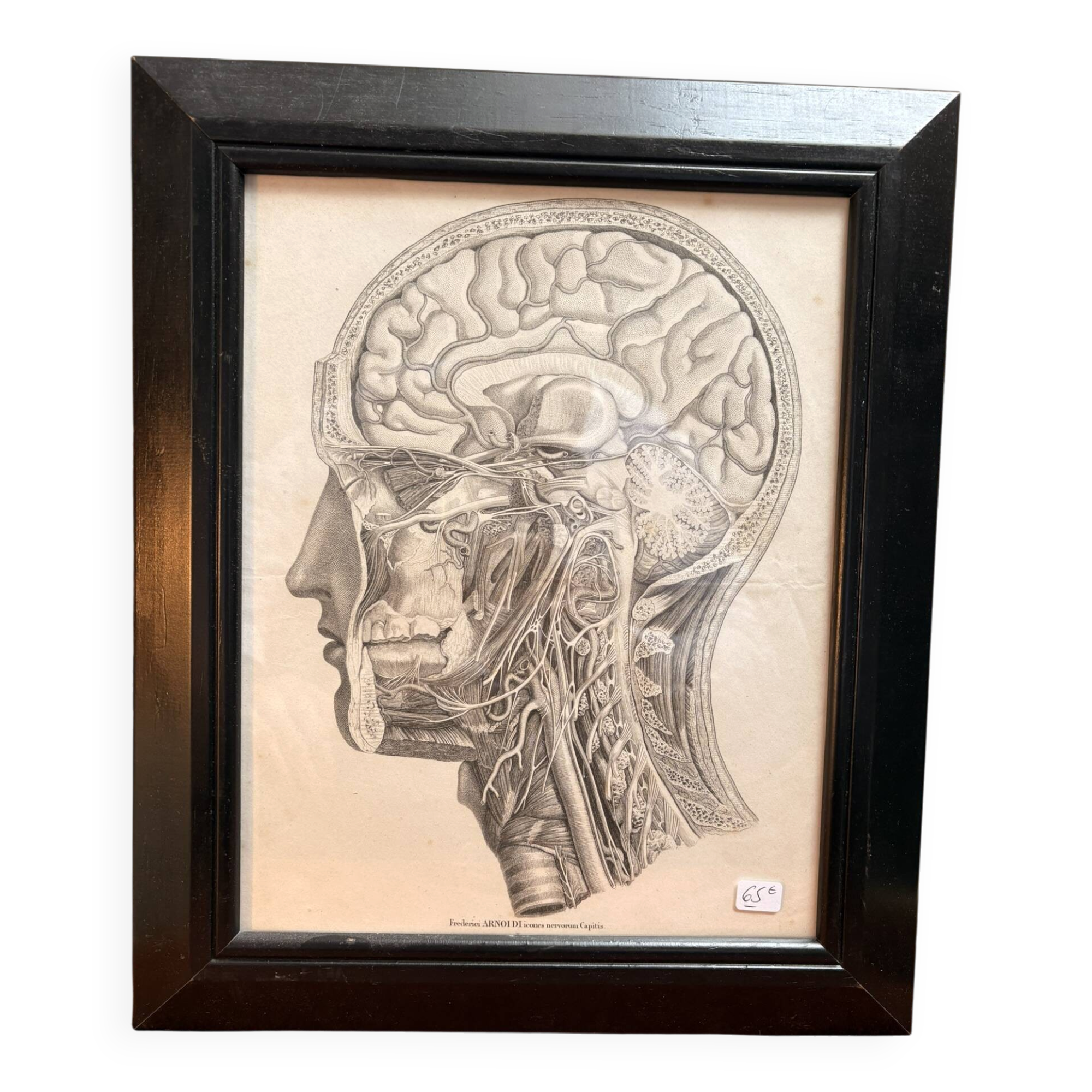 Old Print Engraving by Friderici Arnoldi Icones of the Nerves of the Head