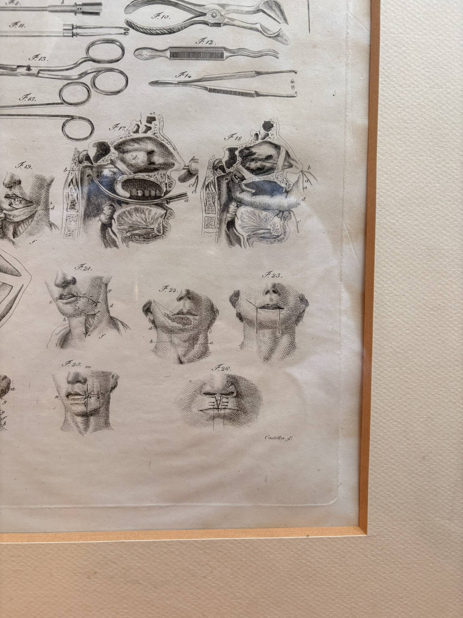 Engraving 19th century Nicolas Jacob Bourgery Medical instruments Anatomy Surgery