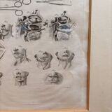 Engraving 19th century Nicolas Jacob Bourgery Medical instruments Anatomy Surgery