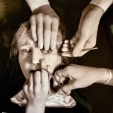 “Schielens Operation (Squint Surgery)” – 1944 Art Photo