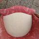 Pair of antique armchairs louis xv style