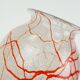 loetz klostermühle art deco glass VASE 1930s orange white and clear glass