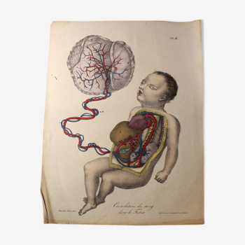 Planche médicale anatomie "circulation du sang dans le foetus"