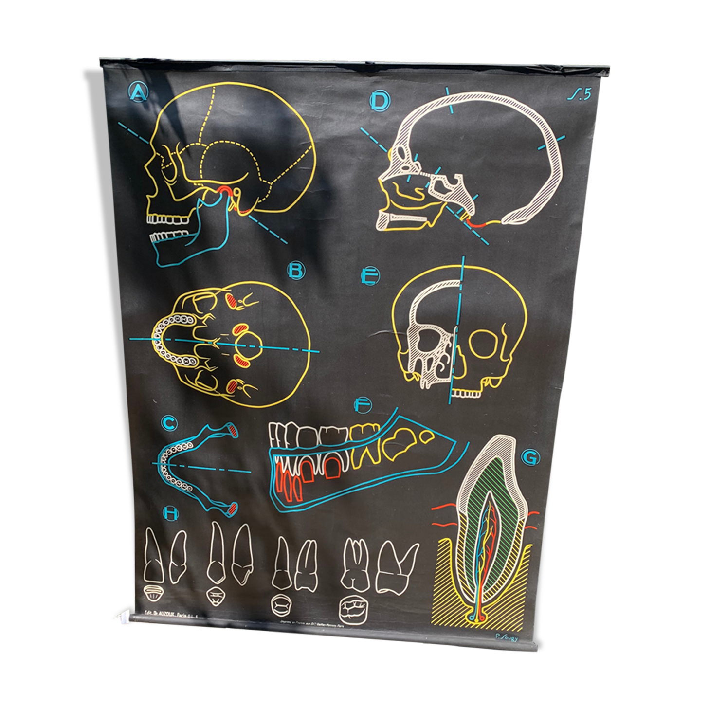 "The skull and the teeth" poster Sougy, Ed. Auzoux