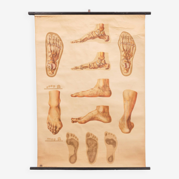 A vintage pull-down medical wall chart illustrating "Orthopedics of Foot" 1930s