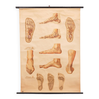 A vintage pull-down medical wall chart illustrating "Orthopedics of Foot" 1930s