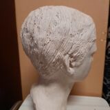 Boy's head in plaster
