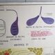 Poster school Nightingale skin no.18 No.17 system friendly