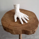 Plaster hand