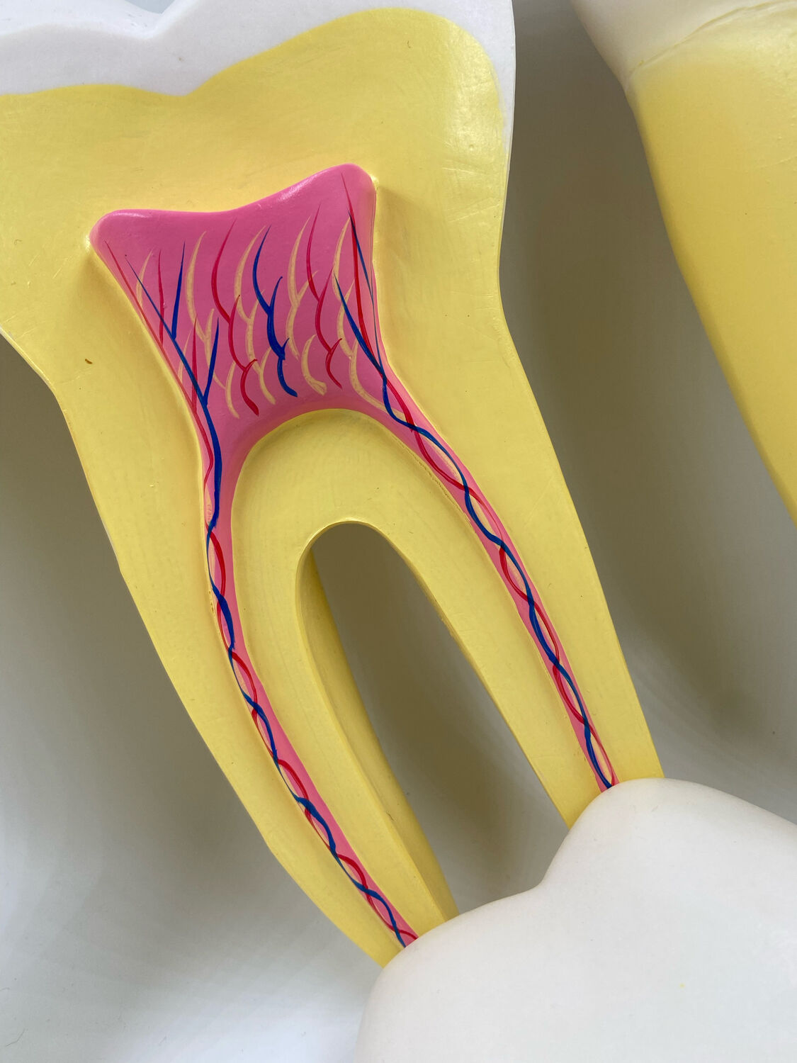 Large size dental model 3 tooth